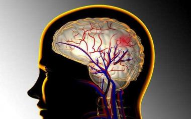 血管因素增加痴呆风险？科学家发现阿尔茨海默发病新机制