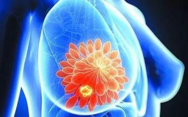 研究称抗氧化食物可降低患乳腺癌风险，女性25岁后每年检查