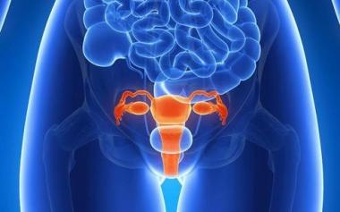 我国每年新增5.2万卵巢癌患者！预防措施有哪些？