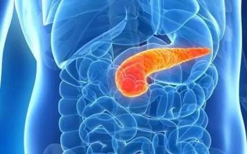 胰腺癌发现便是中晚期，早诊难点在哪里？专家告诉你真相